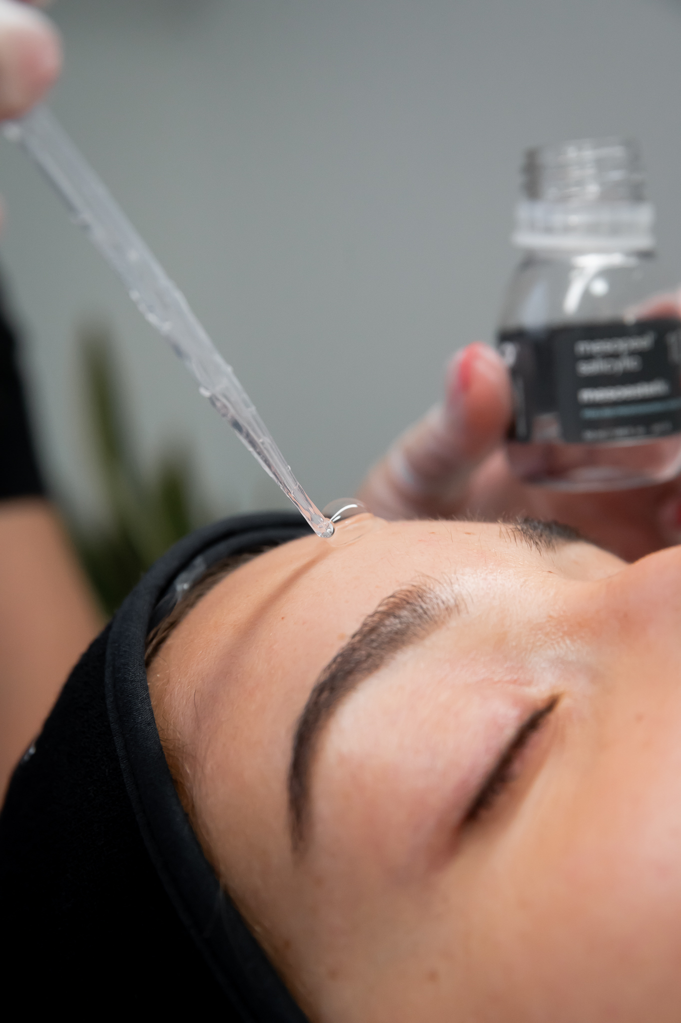 Mesopeel MD Blemiskin